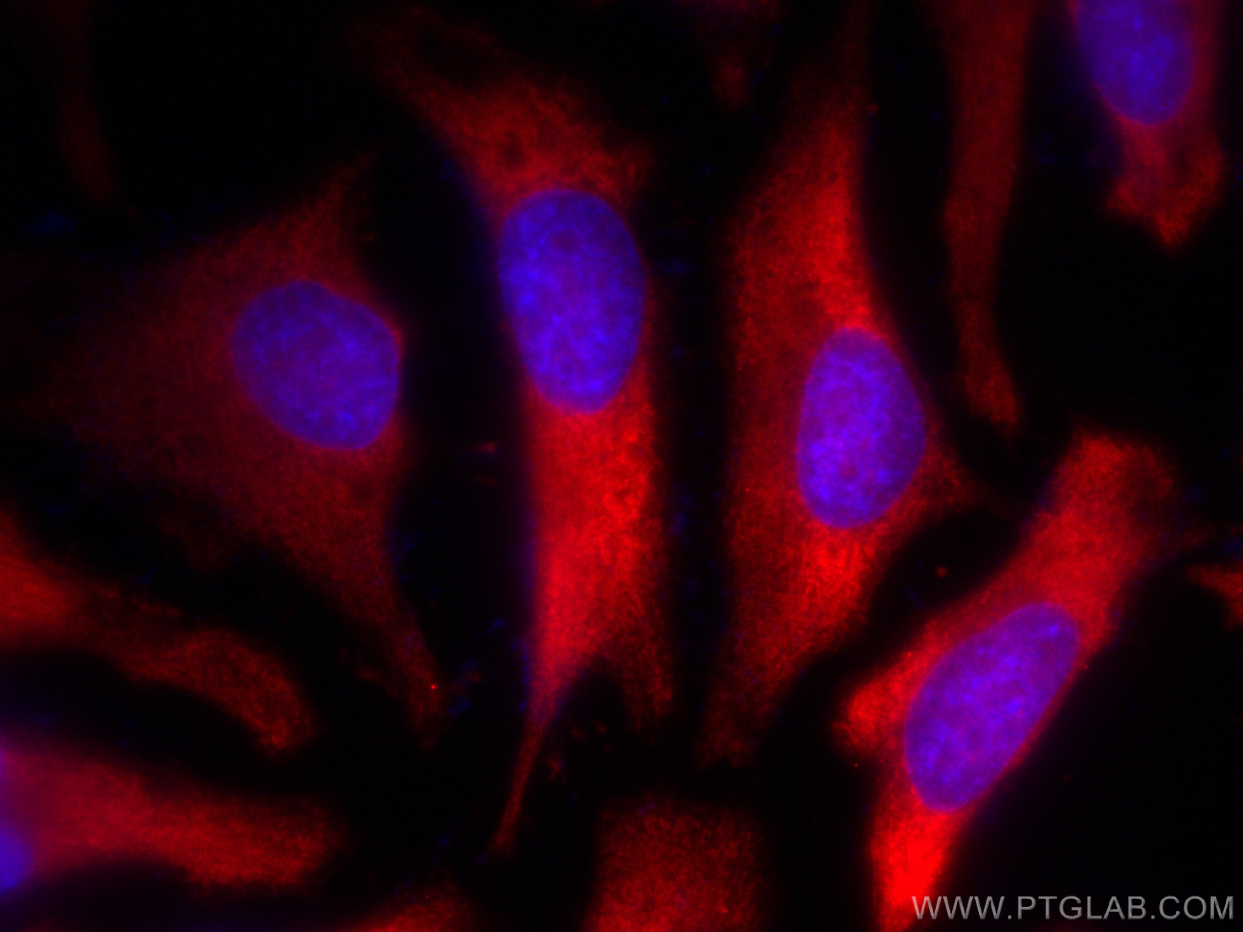 IF Staining of HeLa using CL594-67828