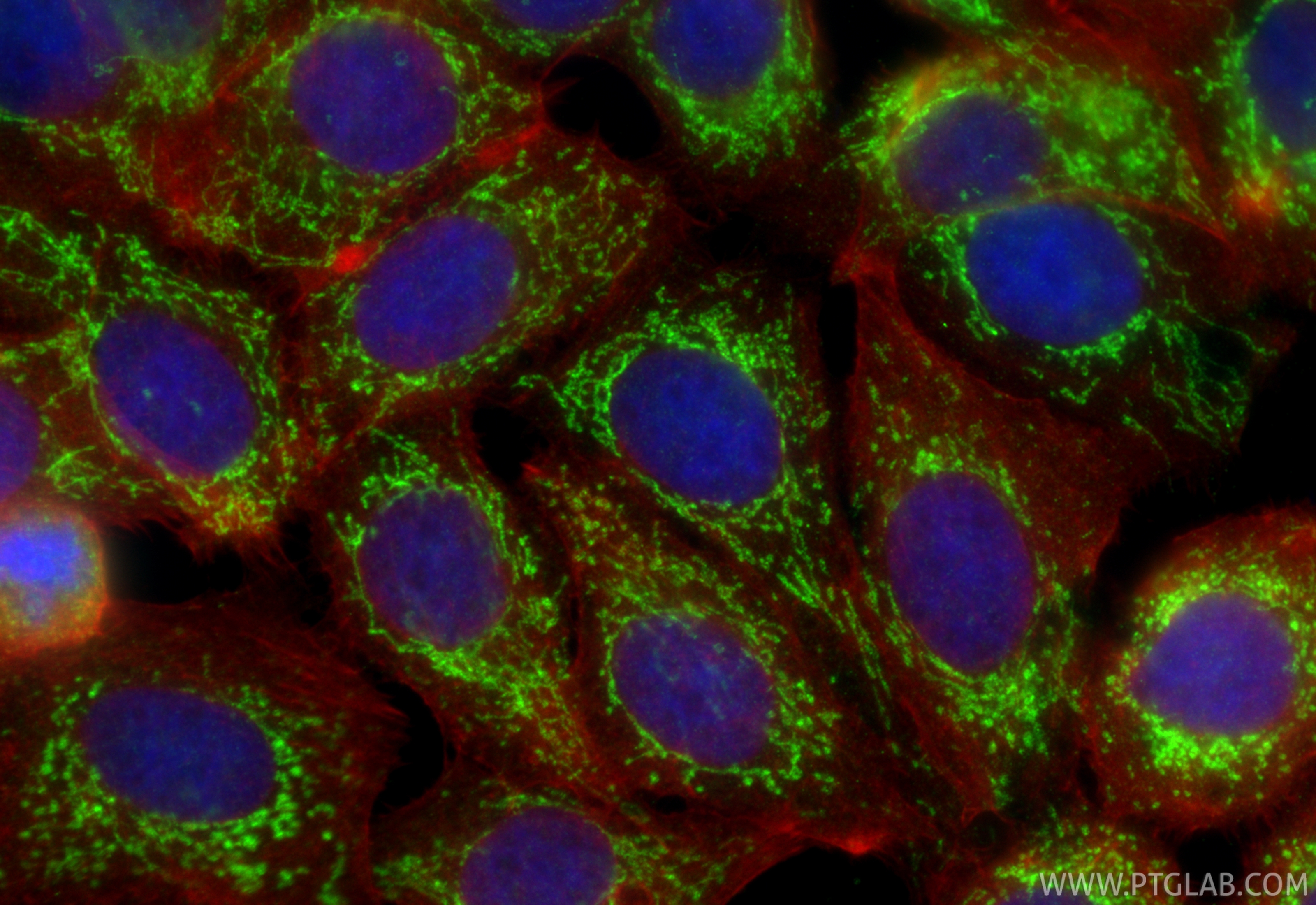 IF Staining of MCF-7 using 15067-1-AP IF Staining of MCF-7 using 15067-1-AP