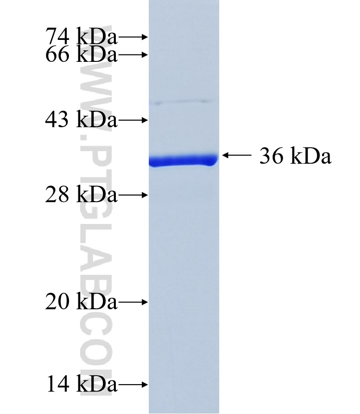 TAS2R10 fusion protein Ag36148 SDS-PAGE TAS2R10 fusion protein Ag36148 SDS-PAGE