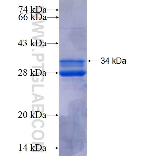 TAS2R5 fusion protein Ag24994 SDS-PAGE TAS2R5 fusion protein Ag24994 SDS-PAGE