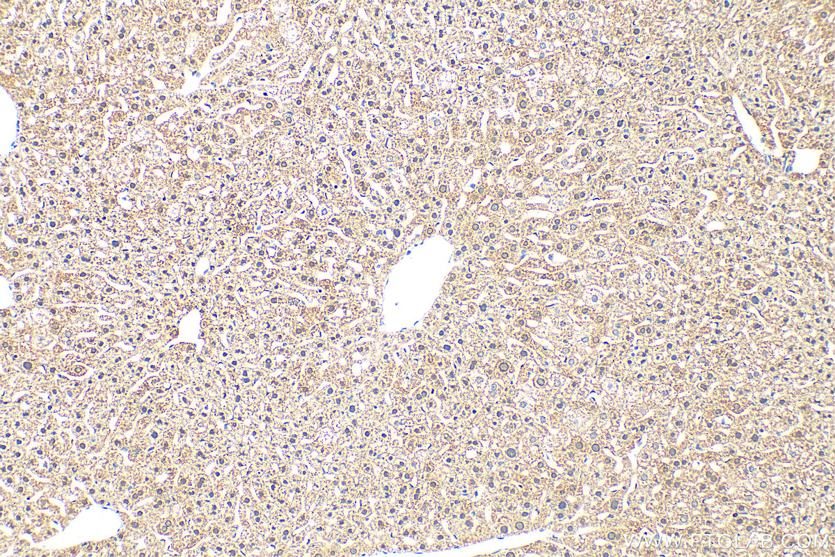 IHC staining of mouse liver using 30188-1-AP