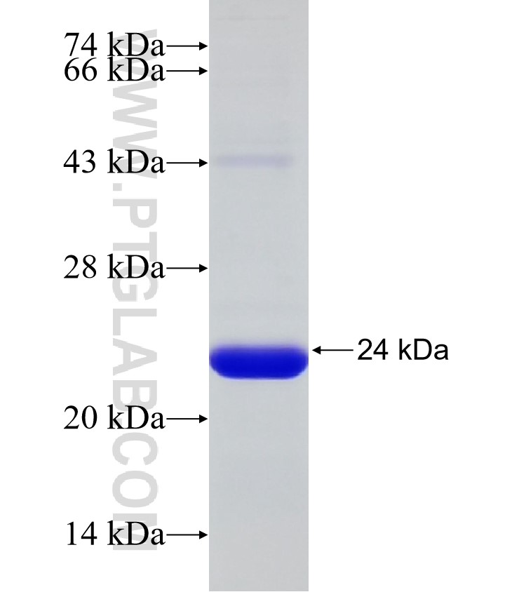 TASOR fusion protein Ag32744 SDS-PAGE