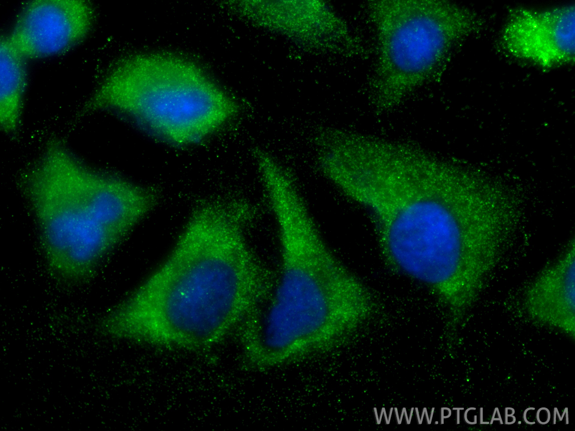IF Staining of A549 using 33698-1-AP