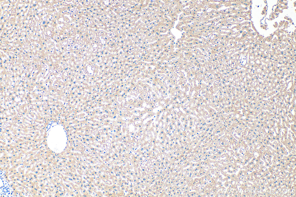 IHC staining of mouse liver using 33698-1-AP