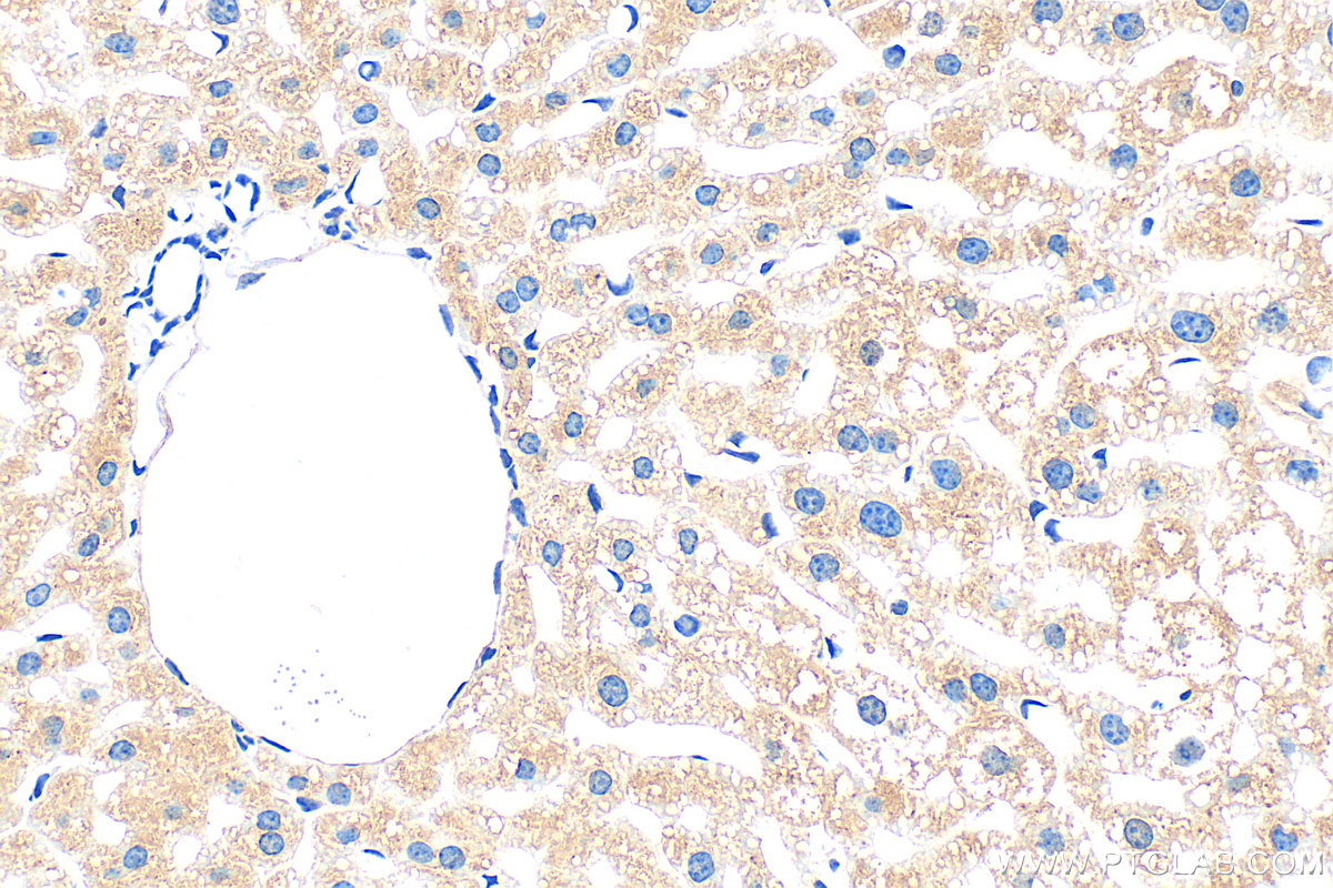 IHC staining of mouse liver using 33698-1-AP