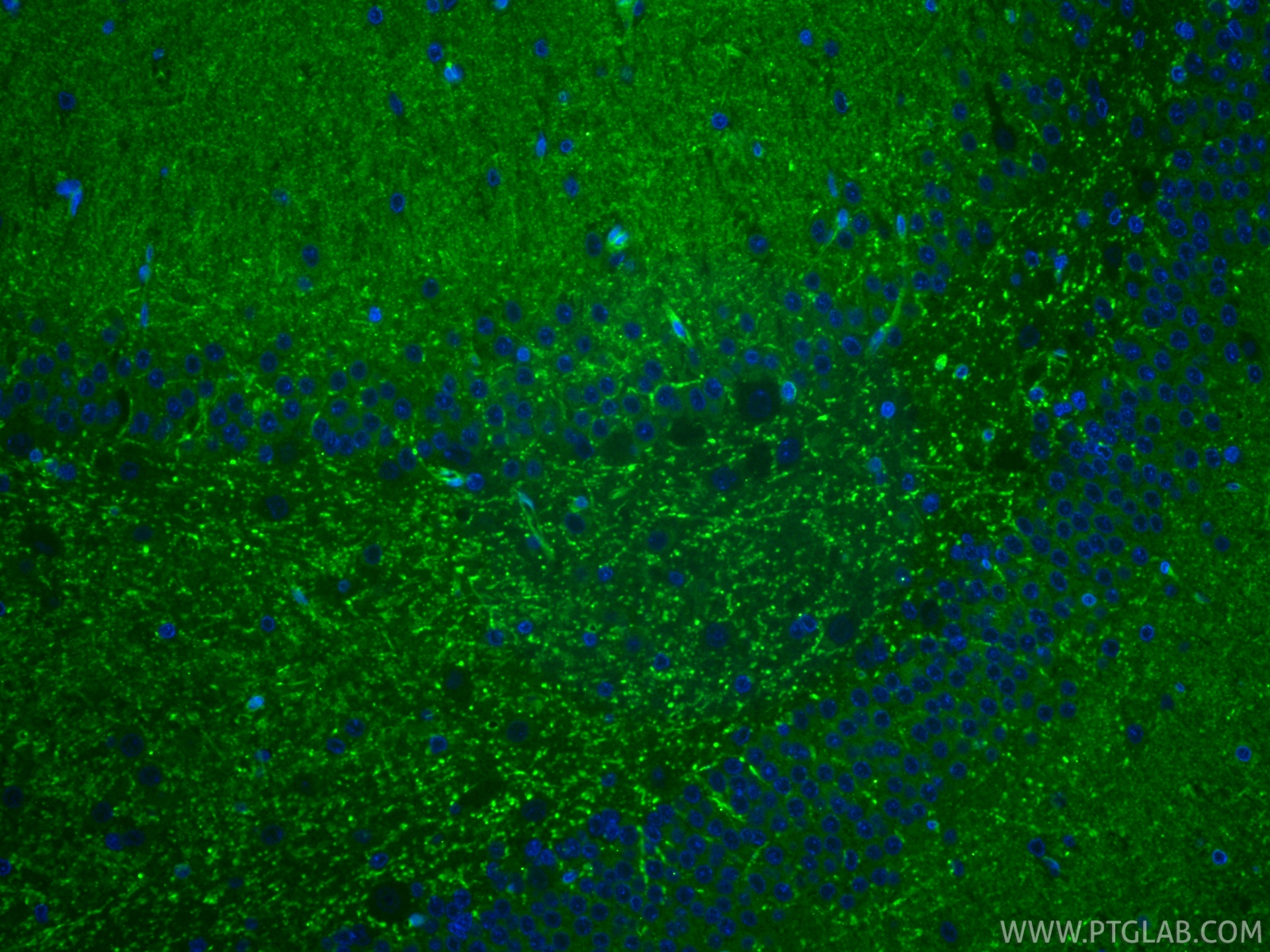 IF Staining of rat brain using 66499-1-Ig (same clone as 66499-1-PBS) IF Staining of rat brain using 66499-1-Ig (same clone as 66499-1-PBS)