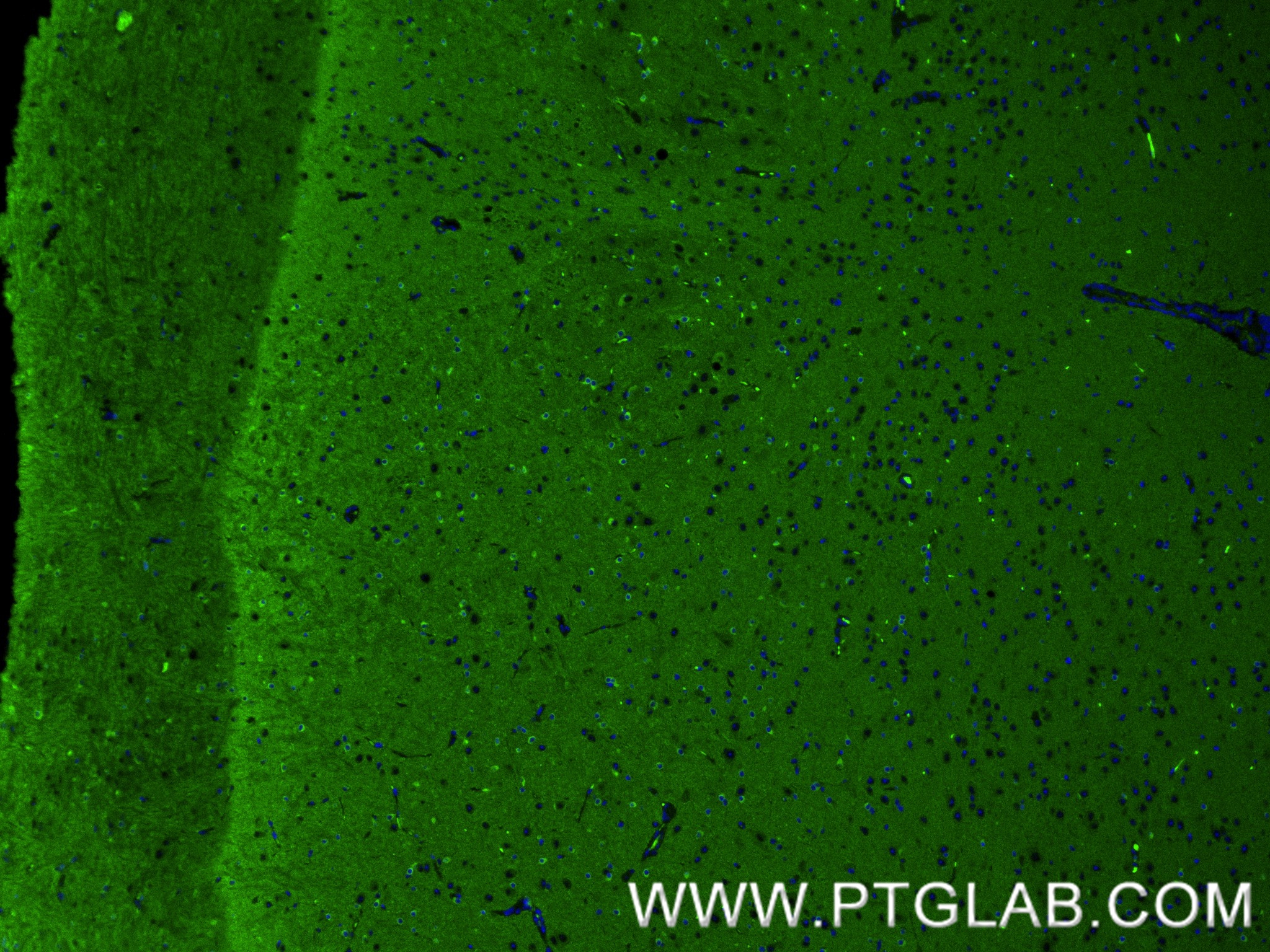 IF Staining of mouse brain using 82846-5-RR IF Staining of mouse brain using 82846-5-RR