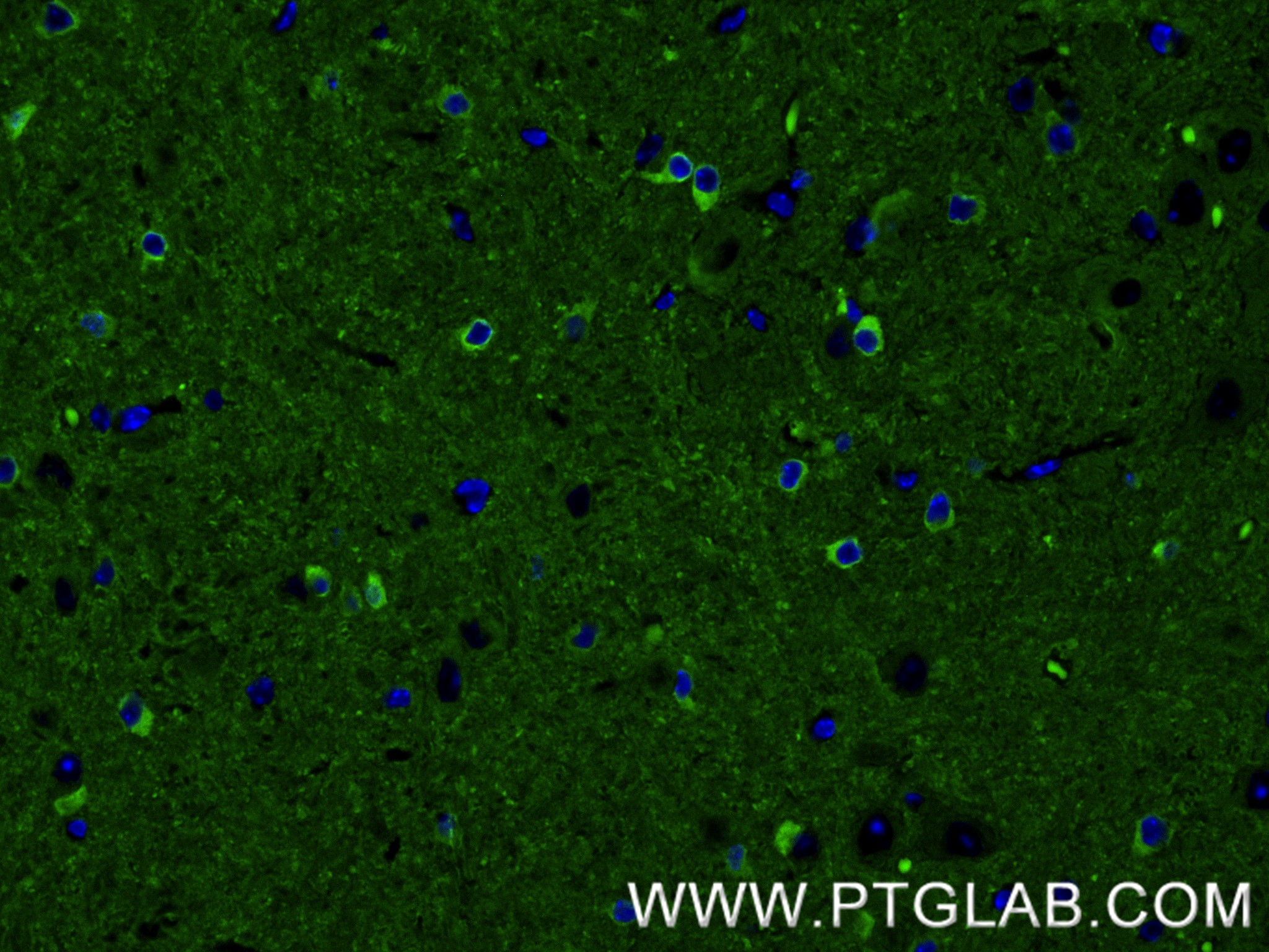 IF Staining of mouse brain using 82846-5-RR IF Staining of mouse brain using 82846-5-RR