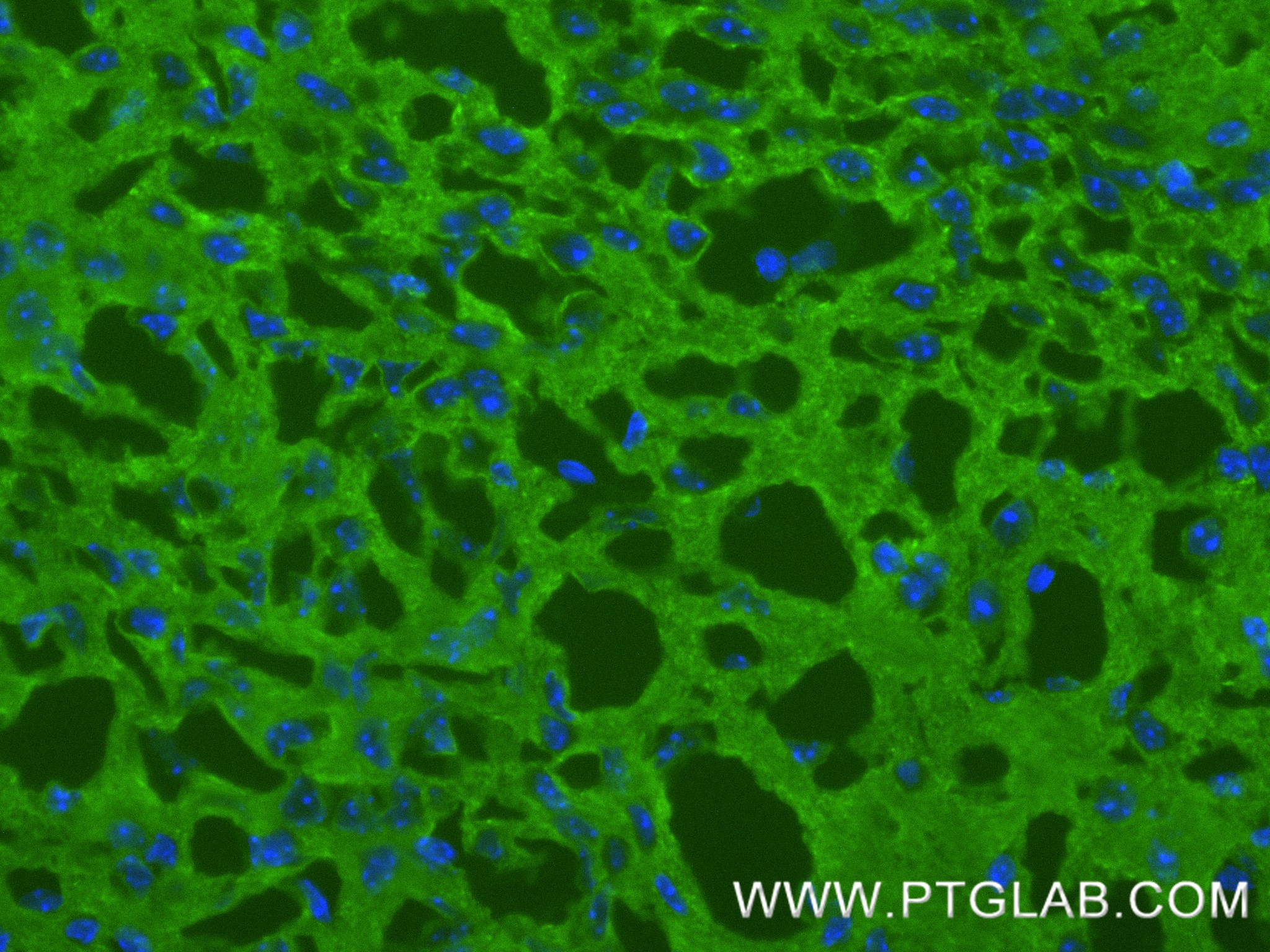IF Staining of mouse brain using 82846-5-RR IF Staining of mouse brain using 82846-5-RR