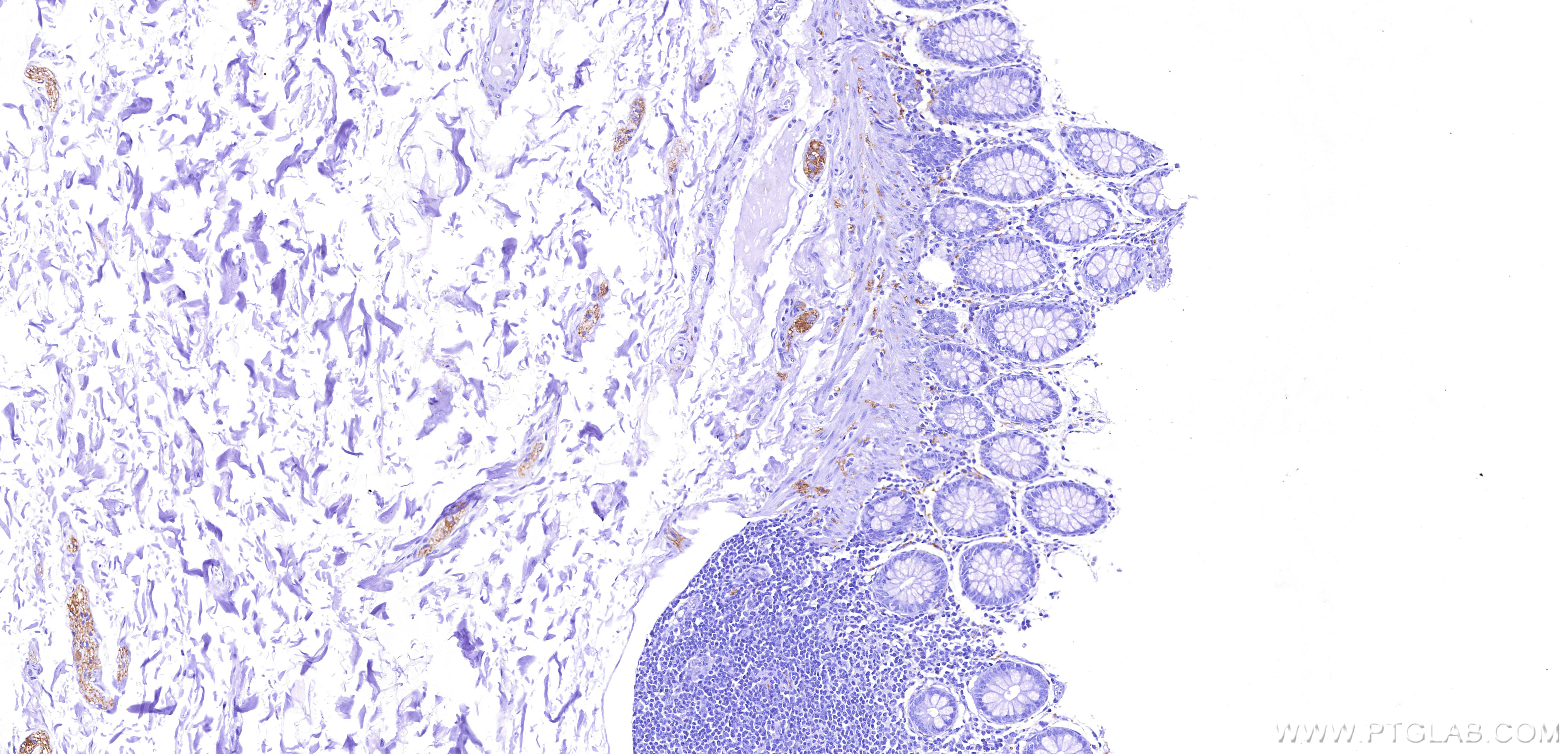 IHC staining of human colon using 82846-5-RR IHC staining of human colon using 82846-5-RR