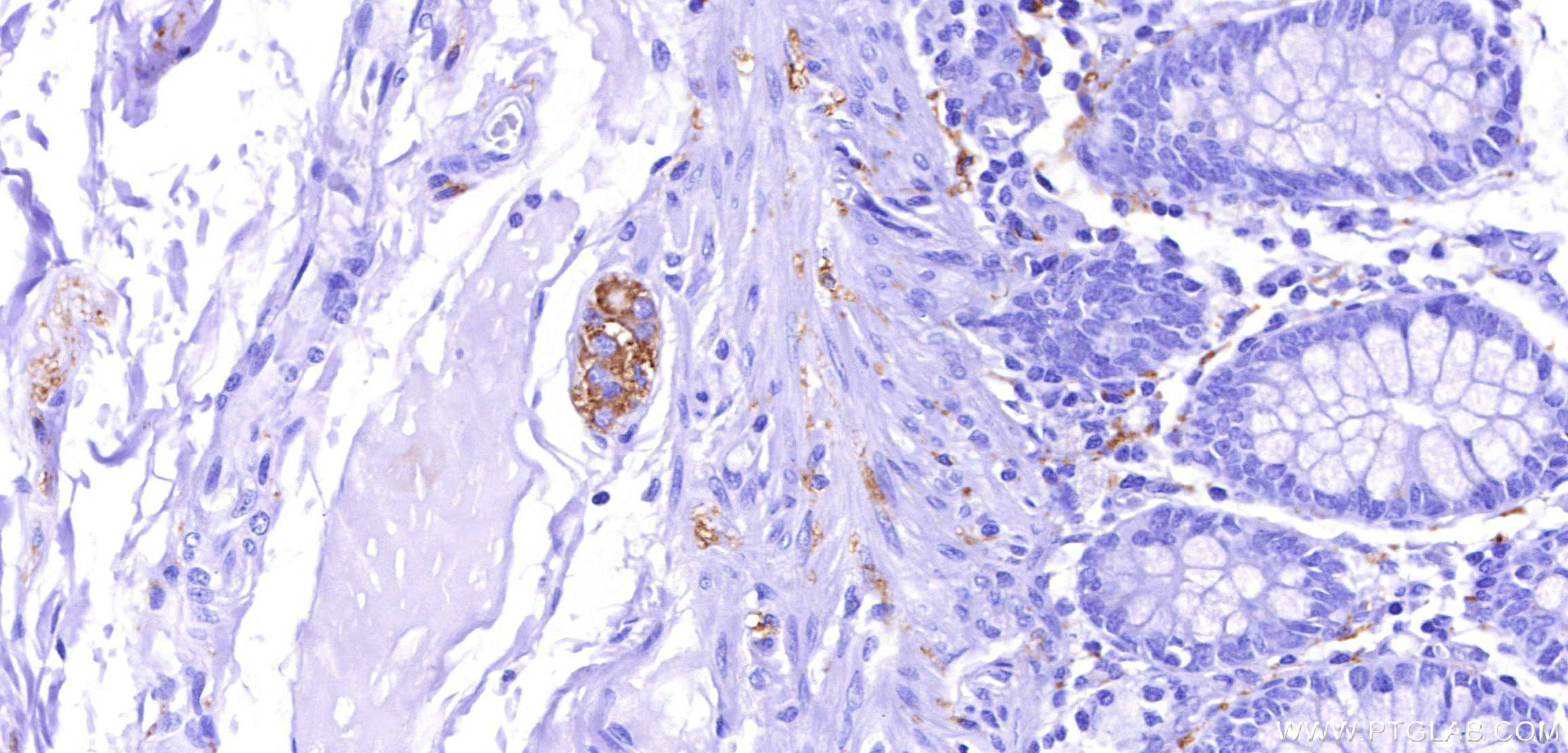 IHC staining of human colon using 82846-5-RR IHC staining of human colon using 82846-5-RR