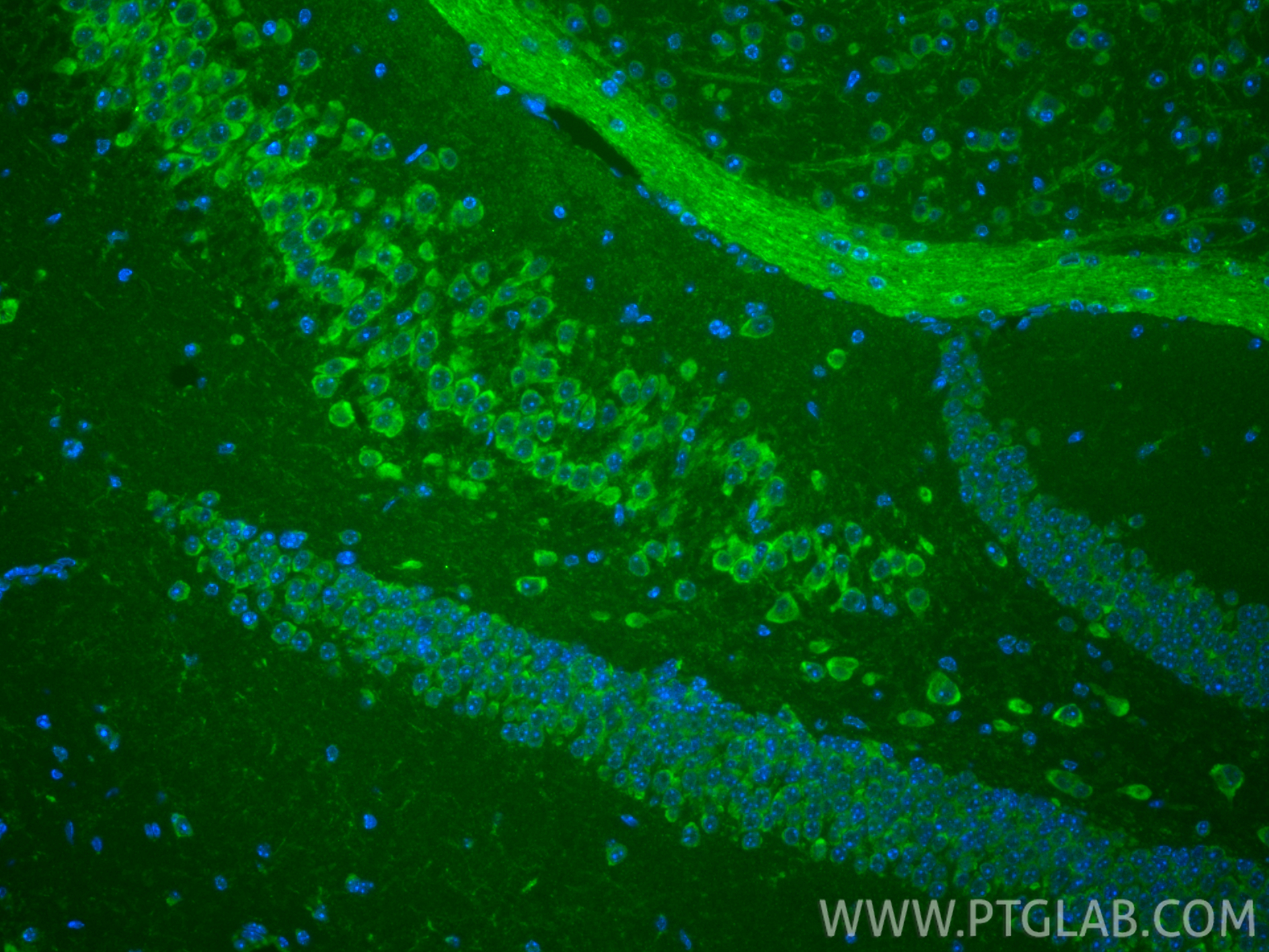 IF Staining of mouse brain using CL488-66499