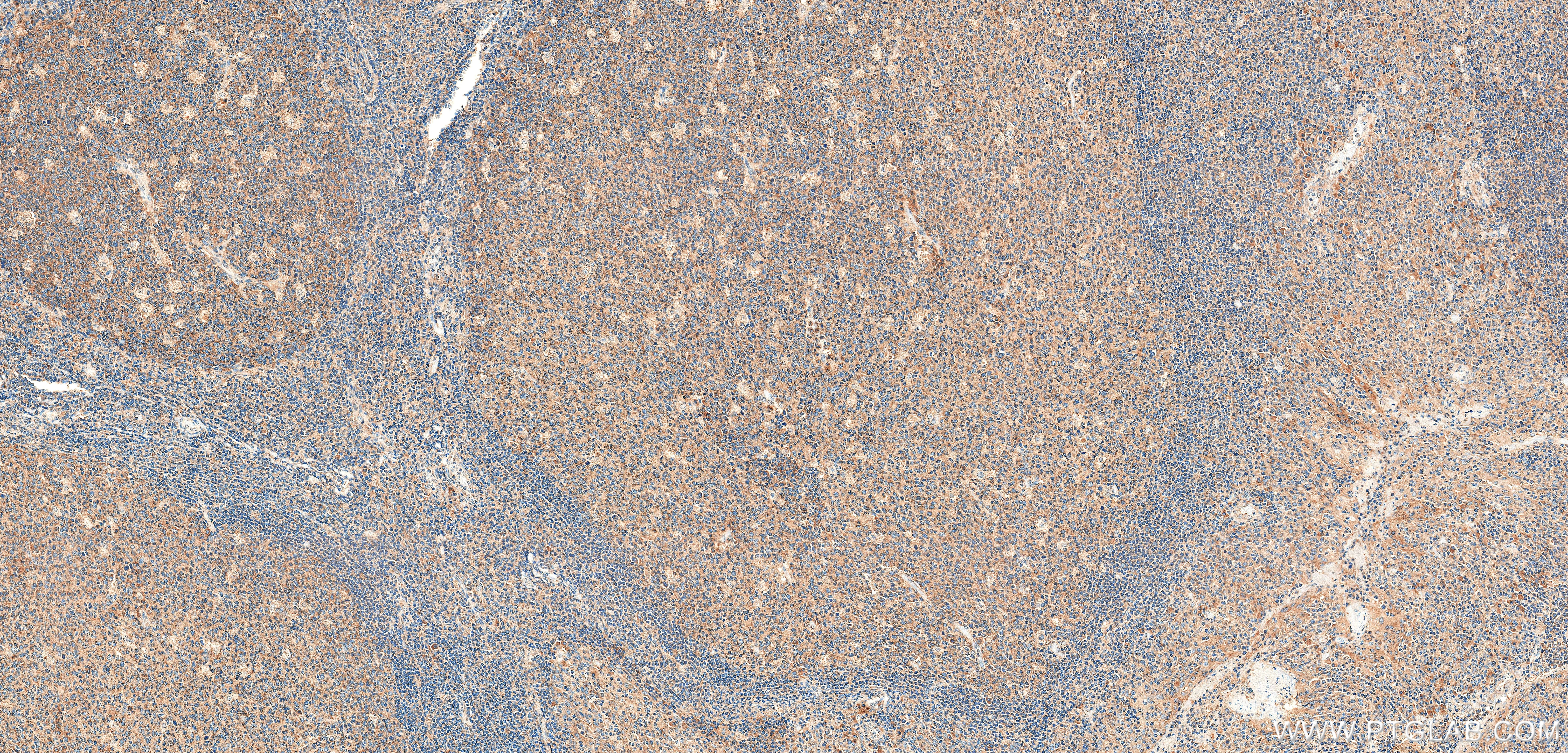 IHC staining of human tonsil using 86602-3-RR
