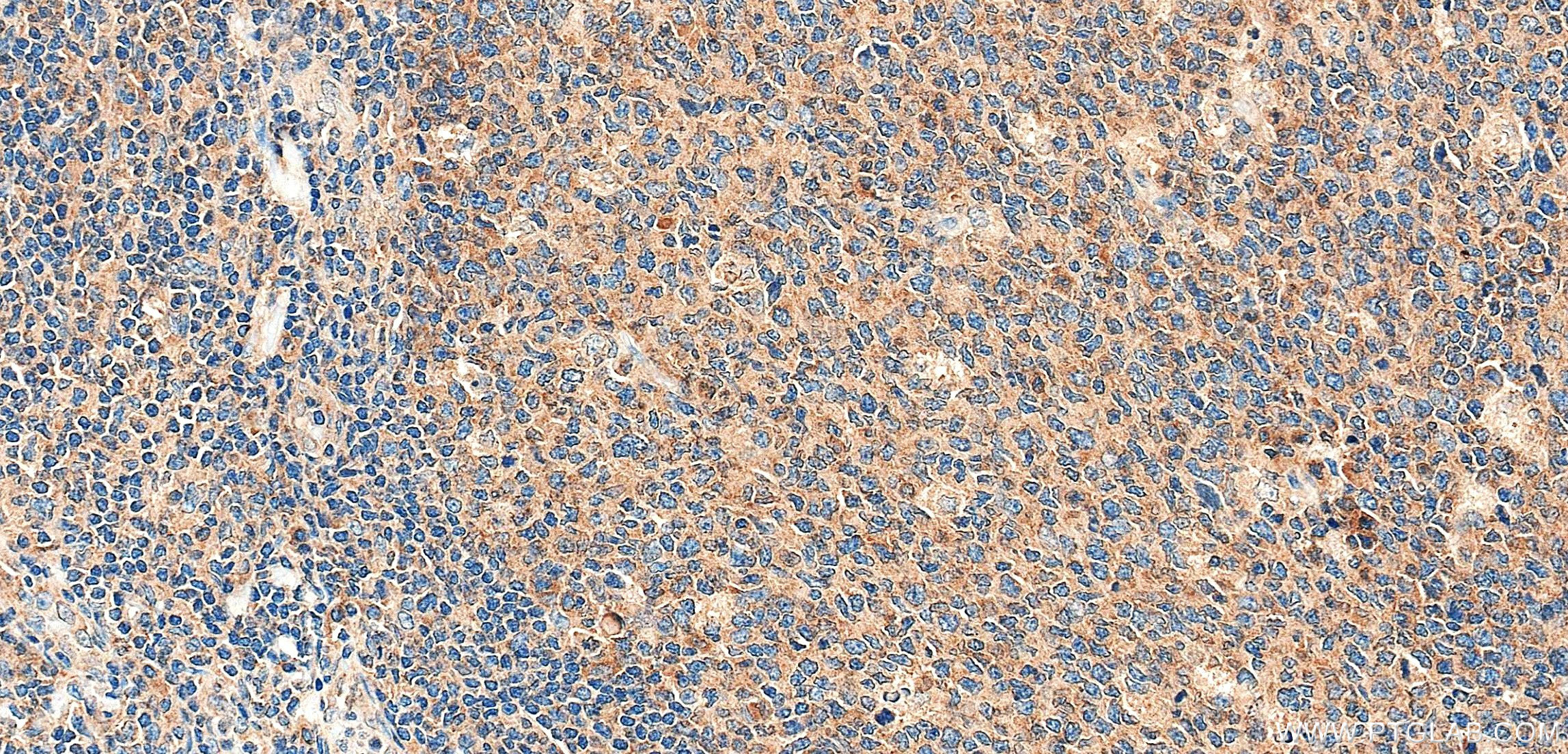 IHC staining of human tonsil using 86602-3-RR (same clone as 86602-3-PBS) IHC staining of human tonsil using 86602-3-RR (same clone as 86602-3-PBS)
