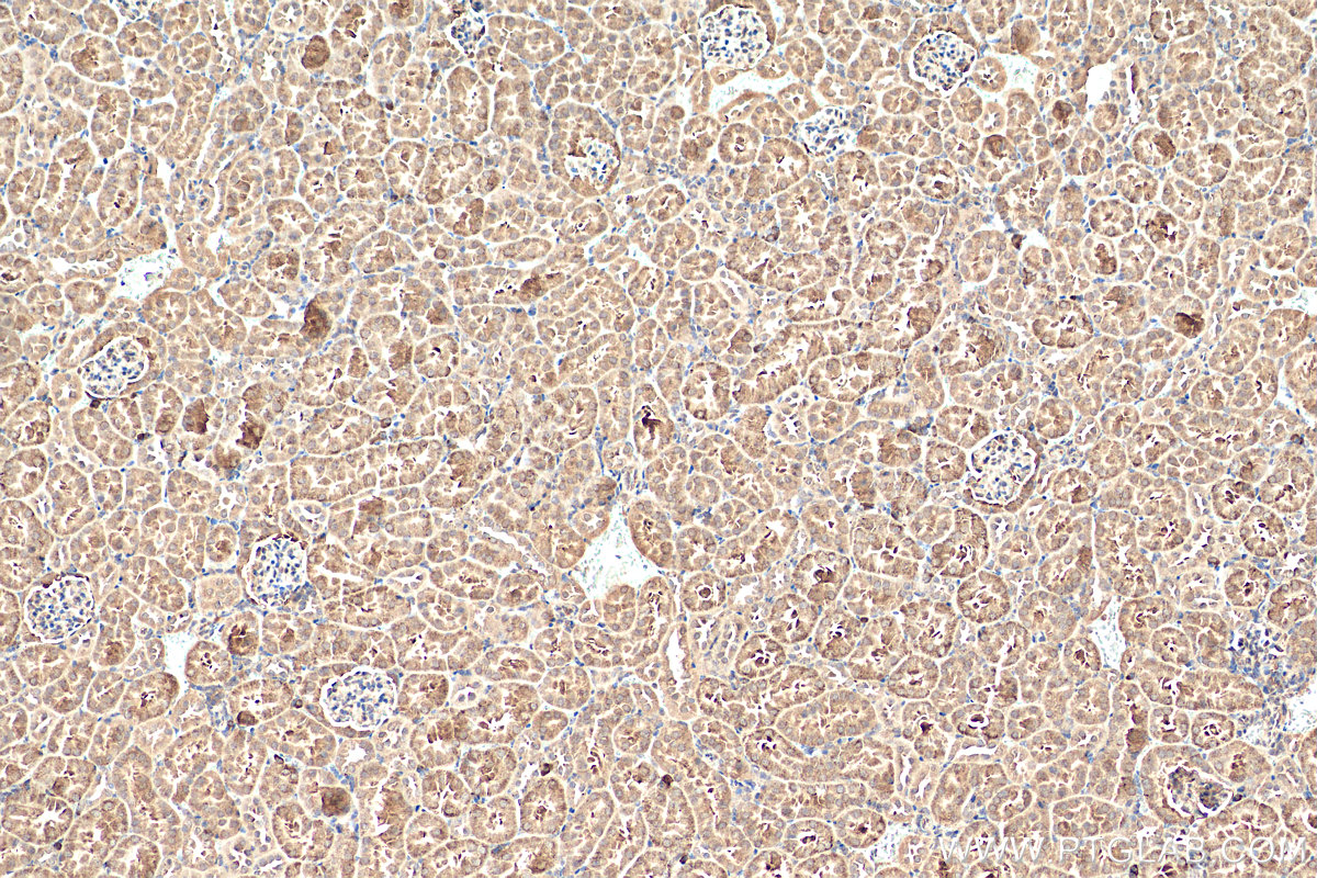 IHC staining of mouse kidney using 22124-1-AP