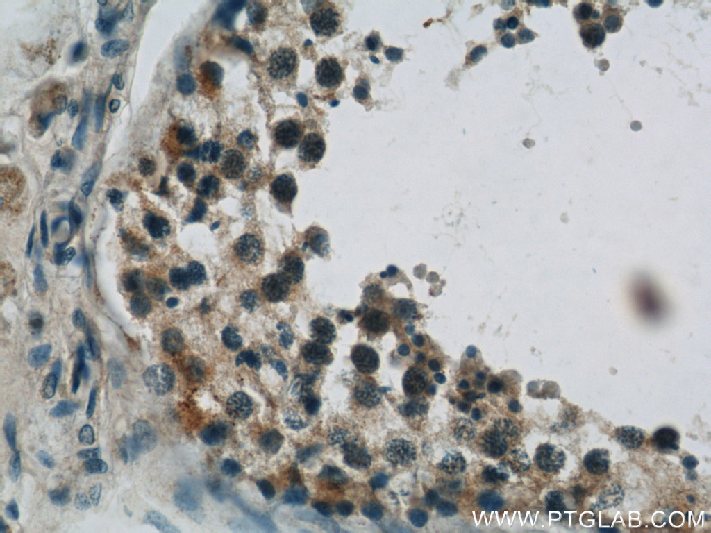 IHC staining of human testis using 22124-1-AP