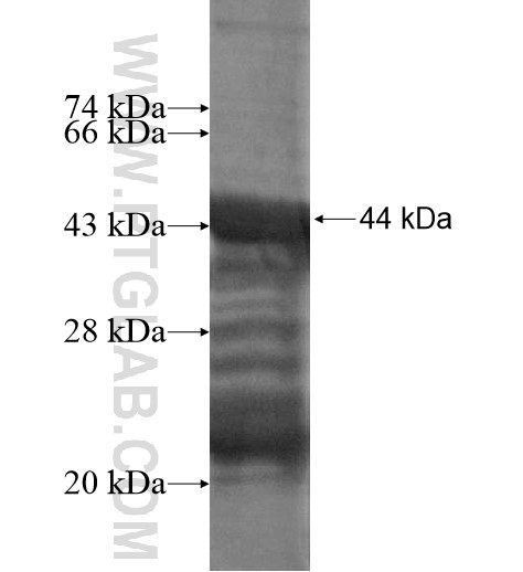 TBC1D10A fusion protein Ag15525 SDS-PAGE TBC1D10A fusion protein Ag15525 SDS-PAGE