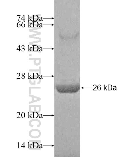 TBC1D13 fusion protein Ag20280 SDS-PAGE TBC1D13 fusion protein Ag20280 SDS-PAGE