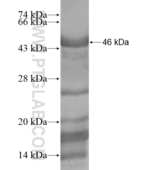 TBC1D14 fusion protein Ag19604 SDS-PAGE TBC1D14 fusion protein Ag19604 SDS-PAGE