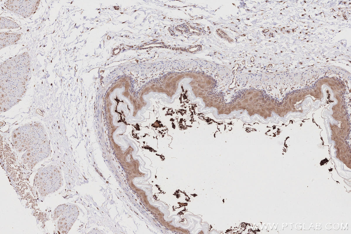 IHC staining of rat stomach using 17252-1-AP IHC staining of rat stomach using 17252-1-AP