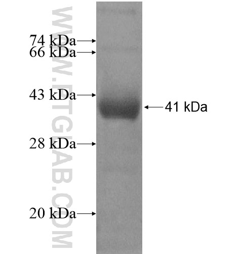 TBC1D16 fusion protein Ag11260 SDS-PAGE TBC1D16 fusion protein Ag11260 SDS-PAGE