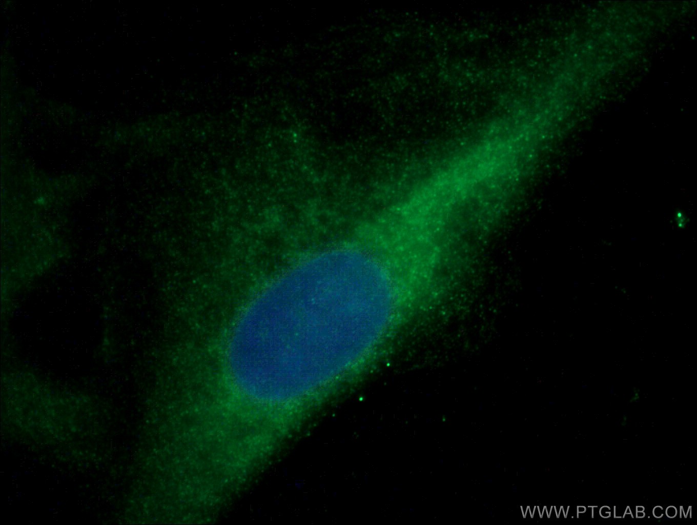 IF Staining of A549 using 20482-1-AP