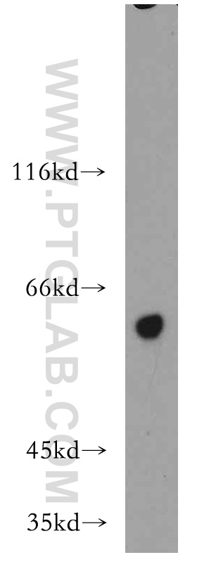 WB analysis of HeLa using 18332-1-AP