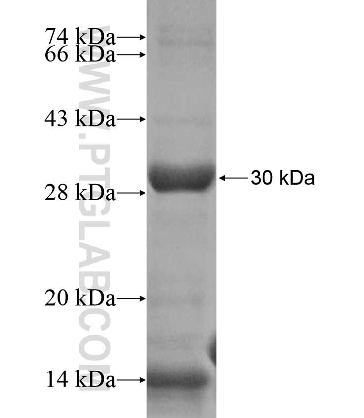 TBC1D22B fusion protein Ag17067 SDS-PAGE
