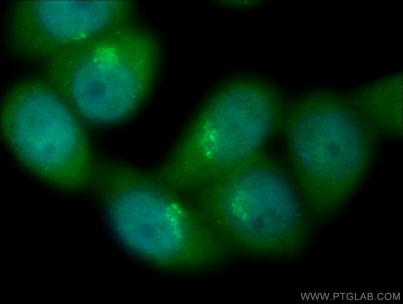 IF Staining of HeLa using 17002-1-AP