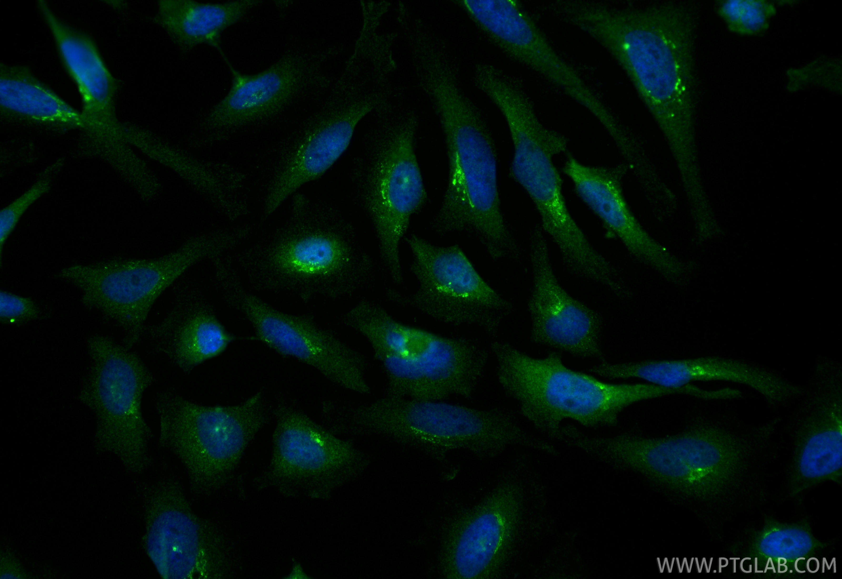 IF Staining of HeLa using 17002-1-AP