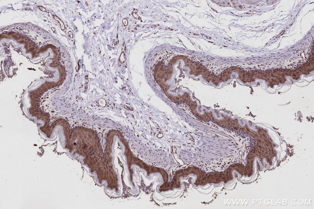 IHC staining of rat stomach using 17002-1-AP