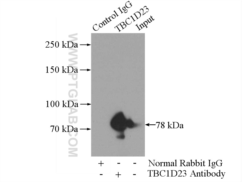 IP experiment of HepG2 using 17002-1-AP