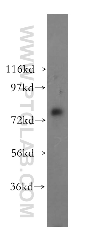 WB analysis of HepG2 using 17002-1-AP