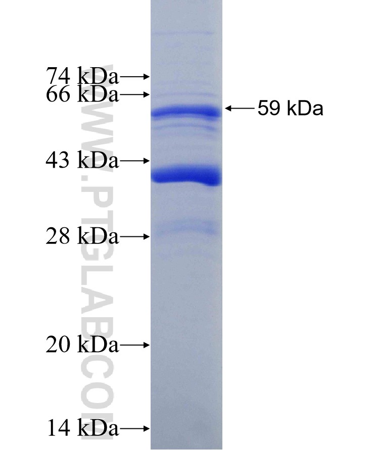 TBC1D25 fusion protein Ag29465 SDS-PAGE TBC1D25 fusion protein Ag29465 SDS-PAGE