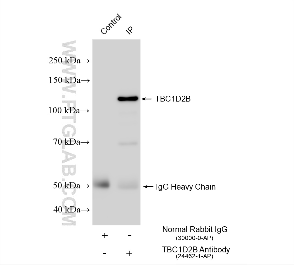 IP experiment of BxPC-3 using 24462-1-AP