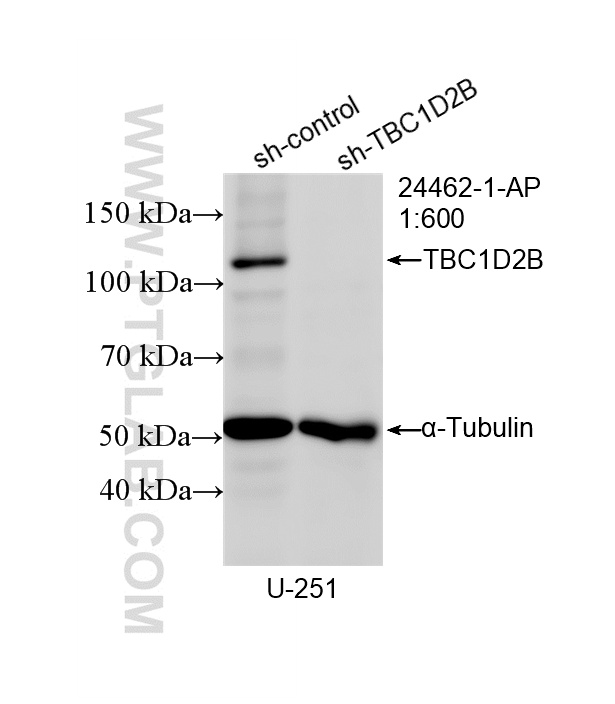 WB analysis of U-251 using 24462-1-AP