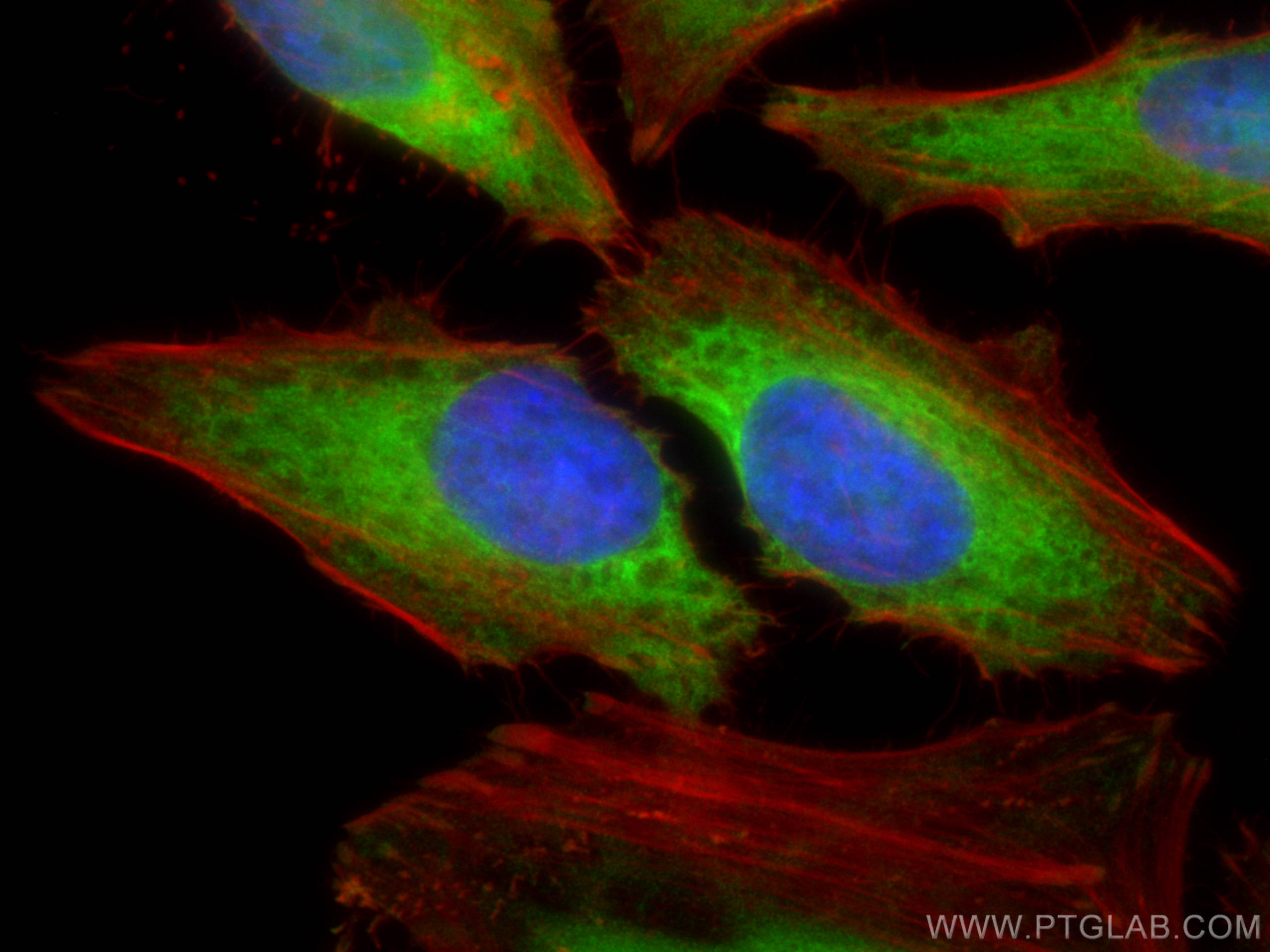 IF Staining of HeLa using 20024-1-AP