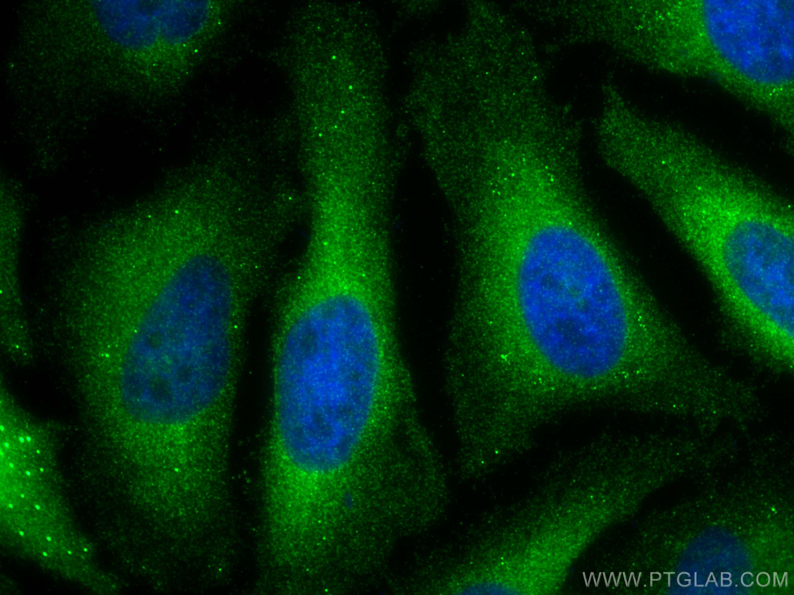 IF Staining of HeLa using 24667-1-AP (same clone as 24667-1-PBS)