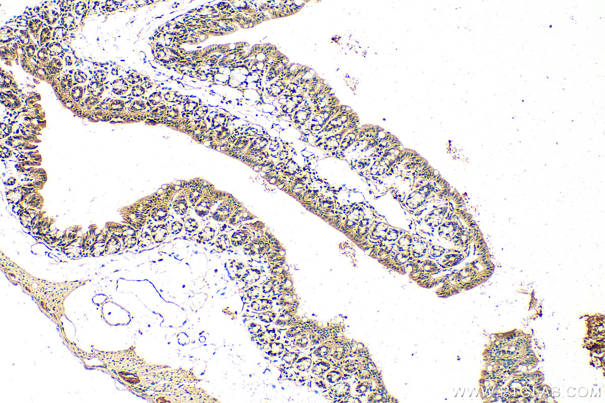 IHC staining of mouse colon using 24667-1-AP (same clone as 24667-1-PBS)