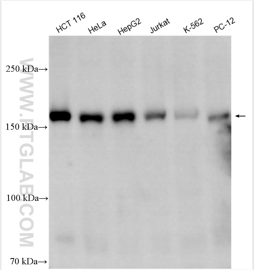 WB analysis using 24667-1-AP (same clone as 24667-1-PBS)
