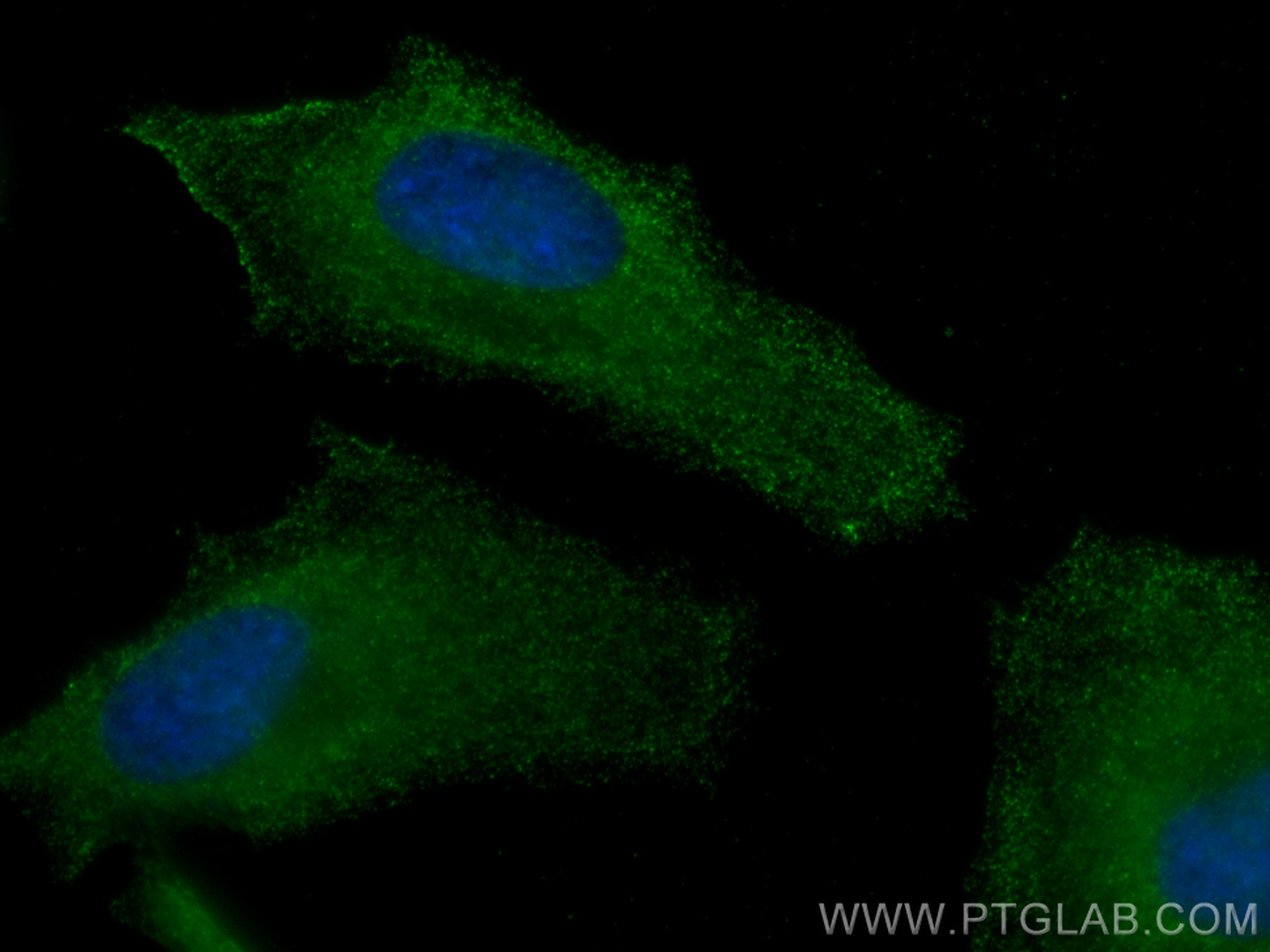 IF Staining of HeLa using CL488-68063