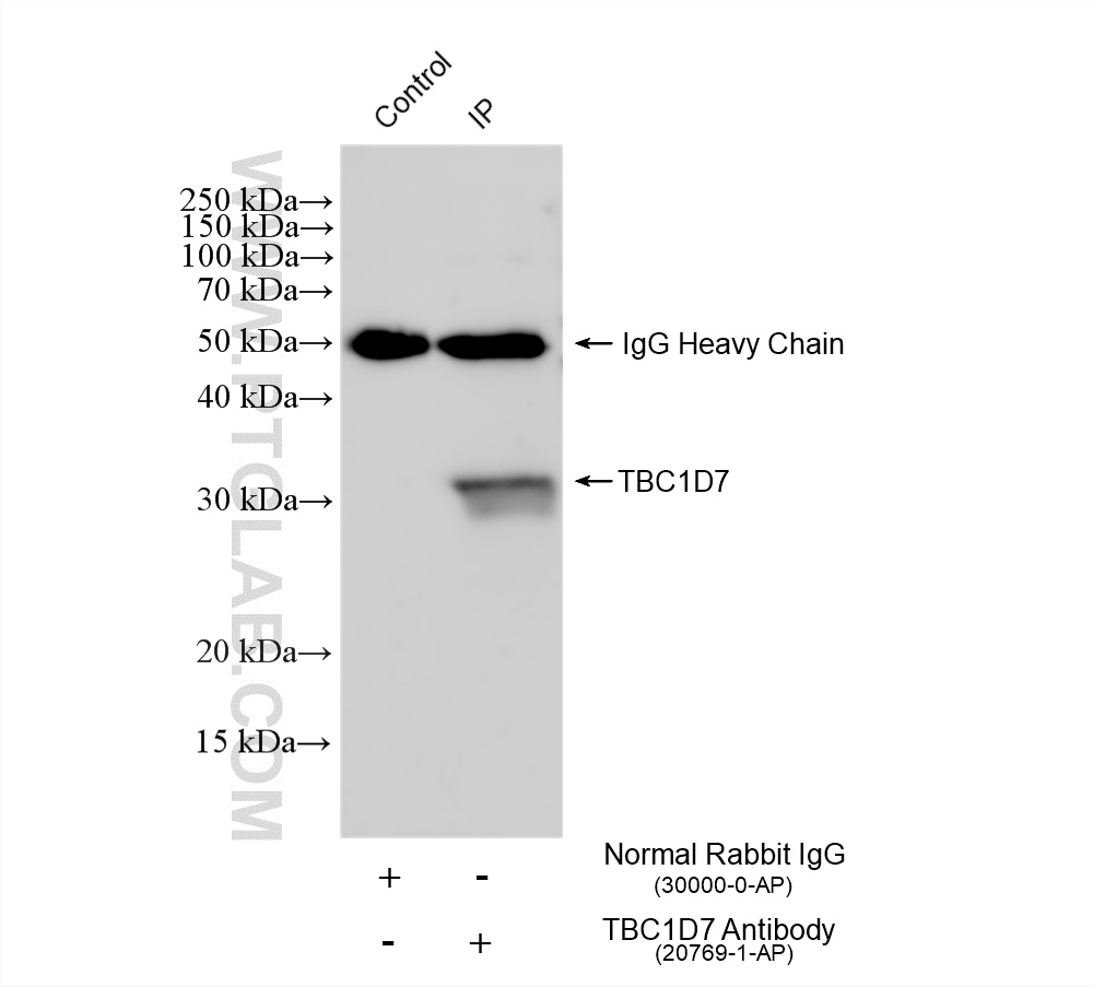 IP experiment of HeLa using 20769-1-AP
