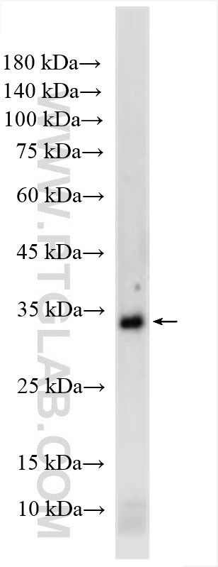 WB analysis of human placenta using 20769-1-AP