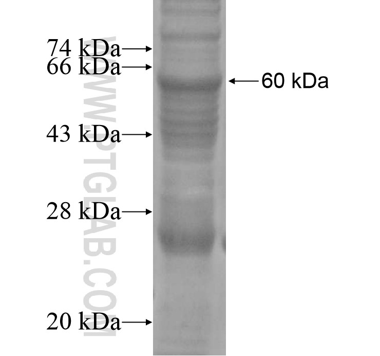 TBC1D7 fusion protein Ag14756 SDS-PAGE TBC1D7 fusion protein Ag14756 SDS-PAGE