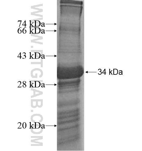 TBC1D7 fusion protein Ag15635 SDS-PAGE TBC1D7 fusion protein Ag15635 SDS-PAGE