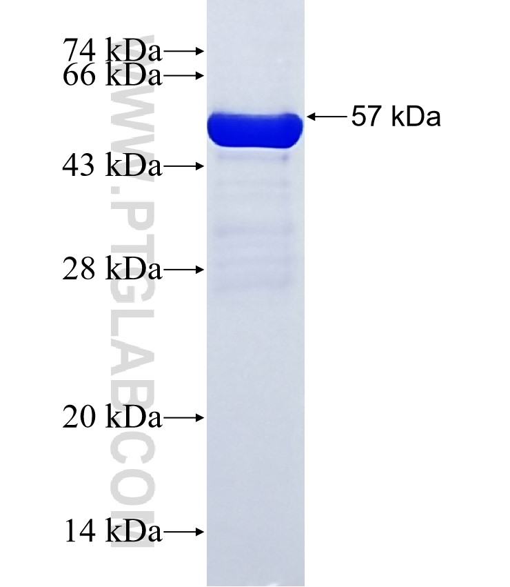 TBC1D8 fusion protein Ag35398 SDS-PAGE TBC1D8 fusion protein Ag35398 SDS-PAGE