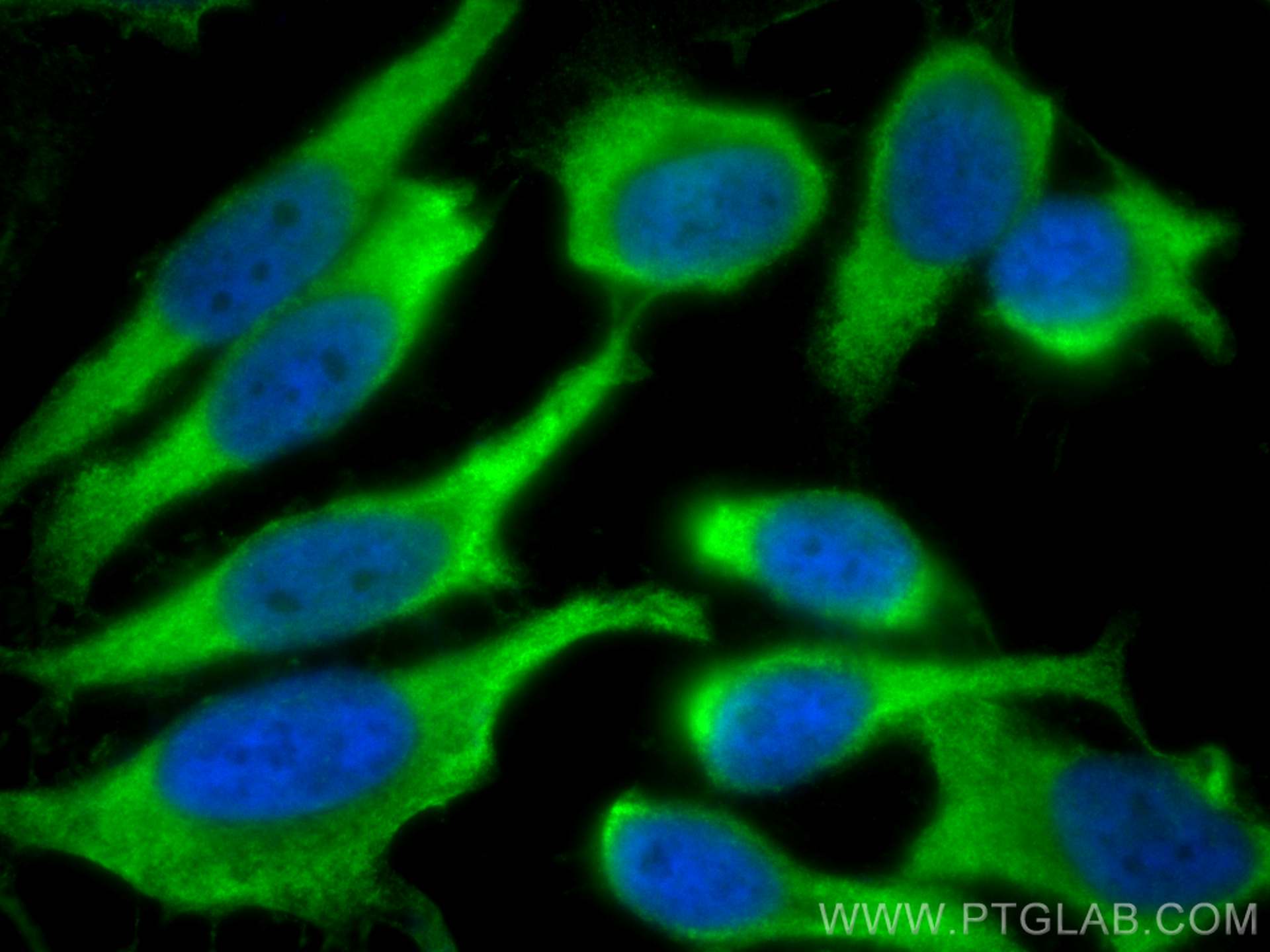 IF Staining of HeLa using 15782-1-AP