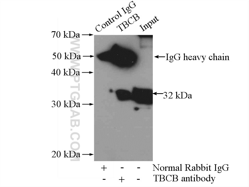 IP experiment of HeLa using 15782-1-AP