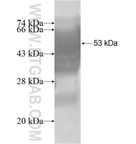 TBCB fusion protein Ag8473 SDS-PAGE