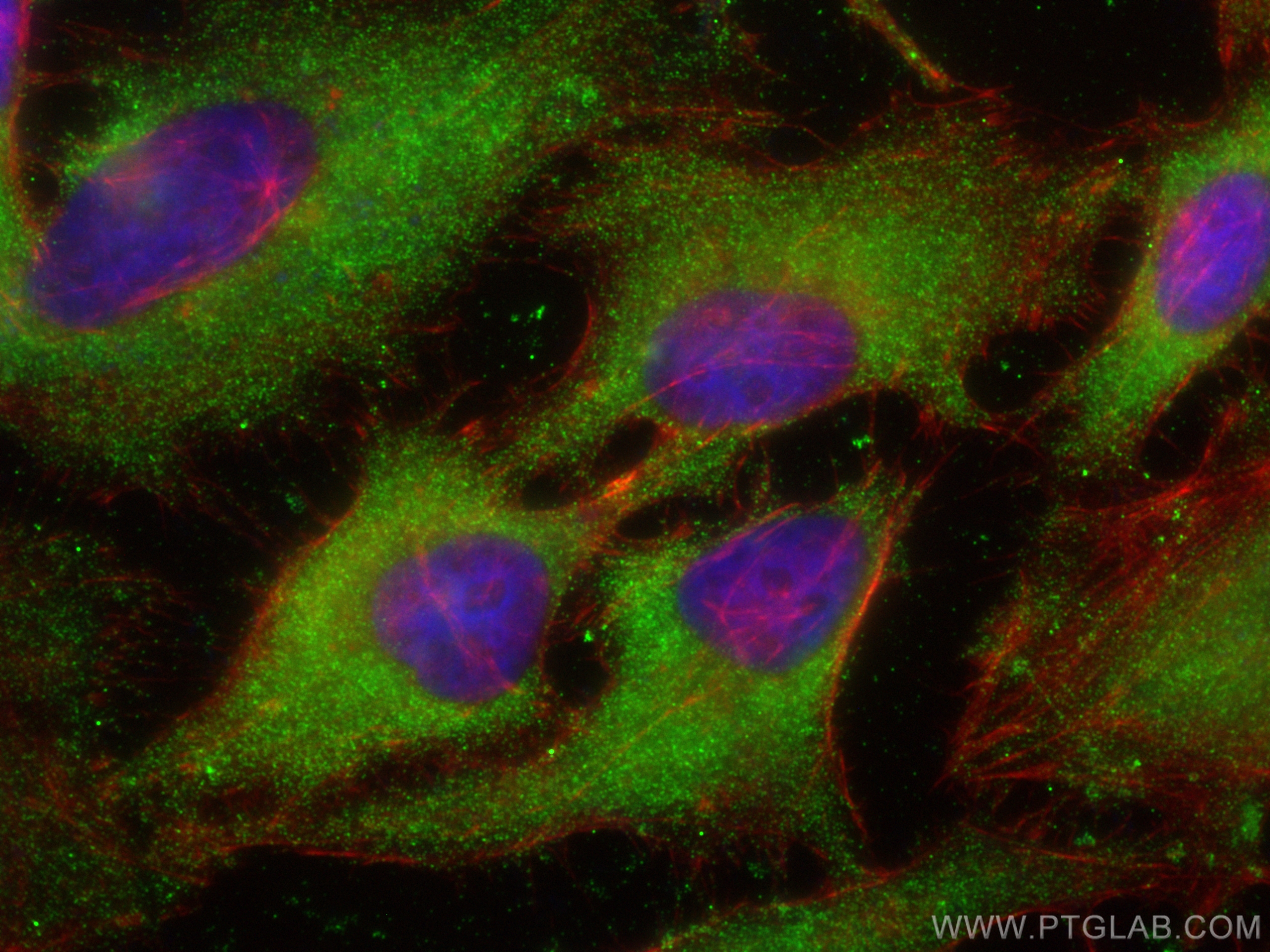 IF Staining of HeLa using 68371-1-Ig